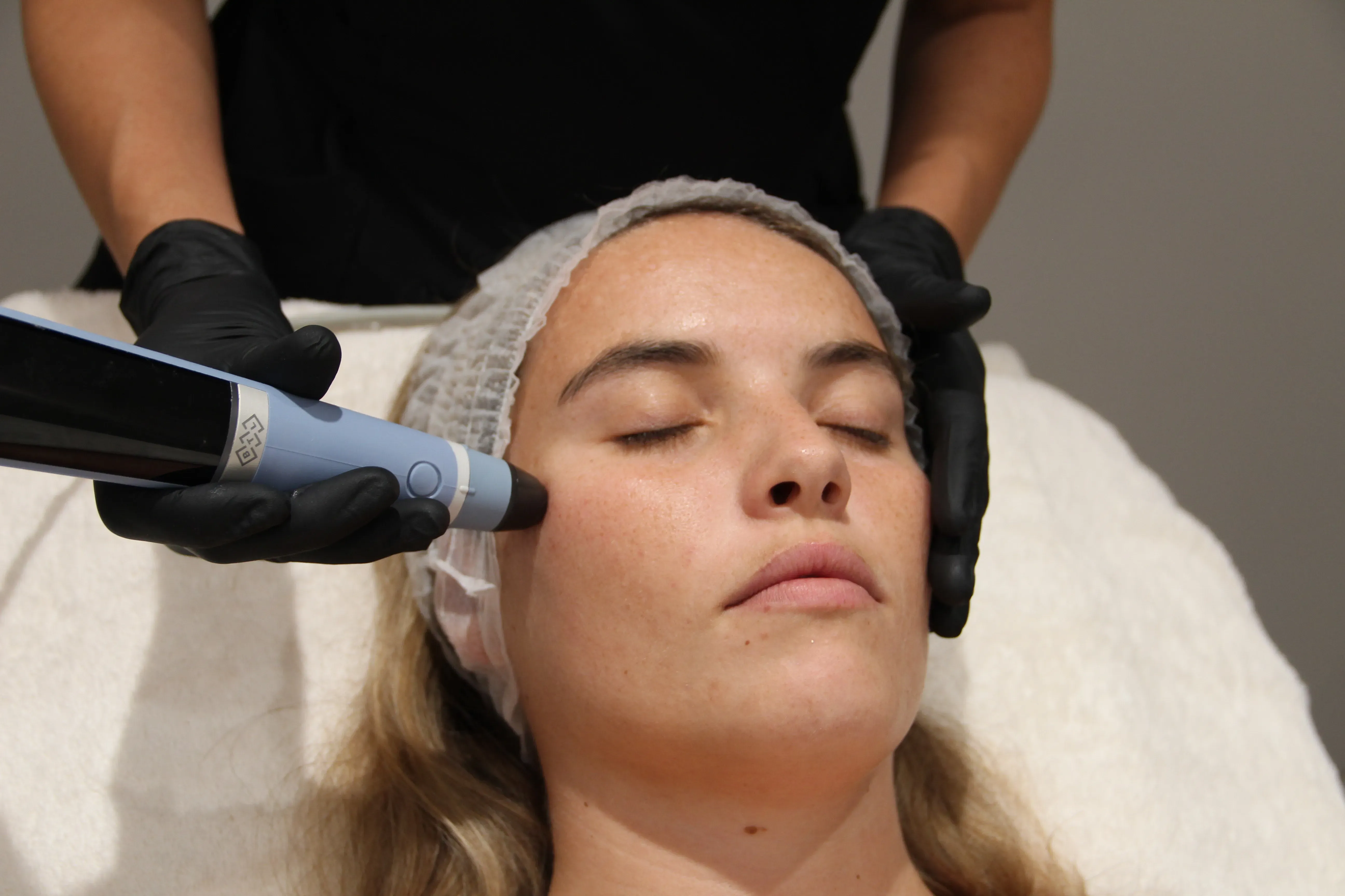 Radiofrecuencia Ablativa