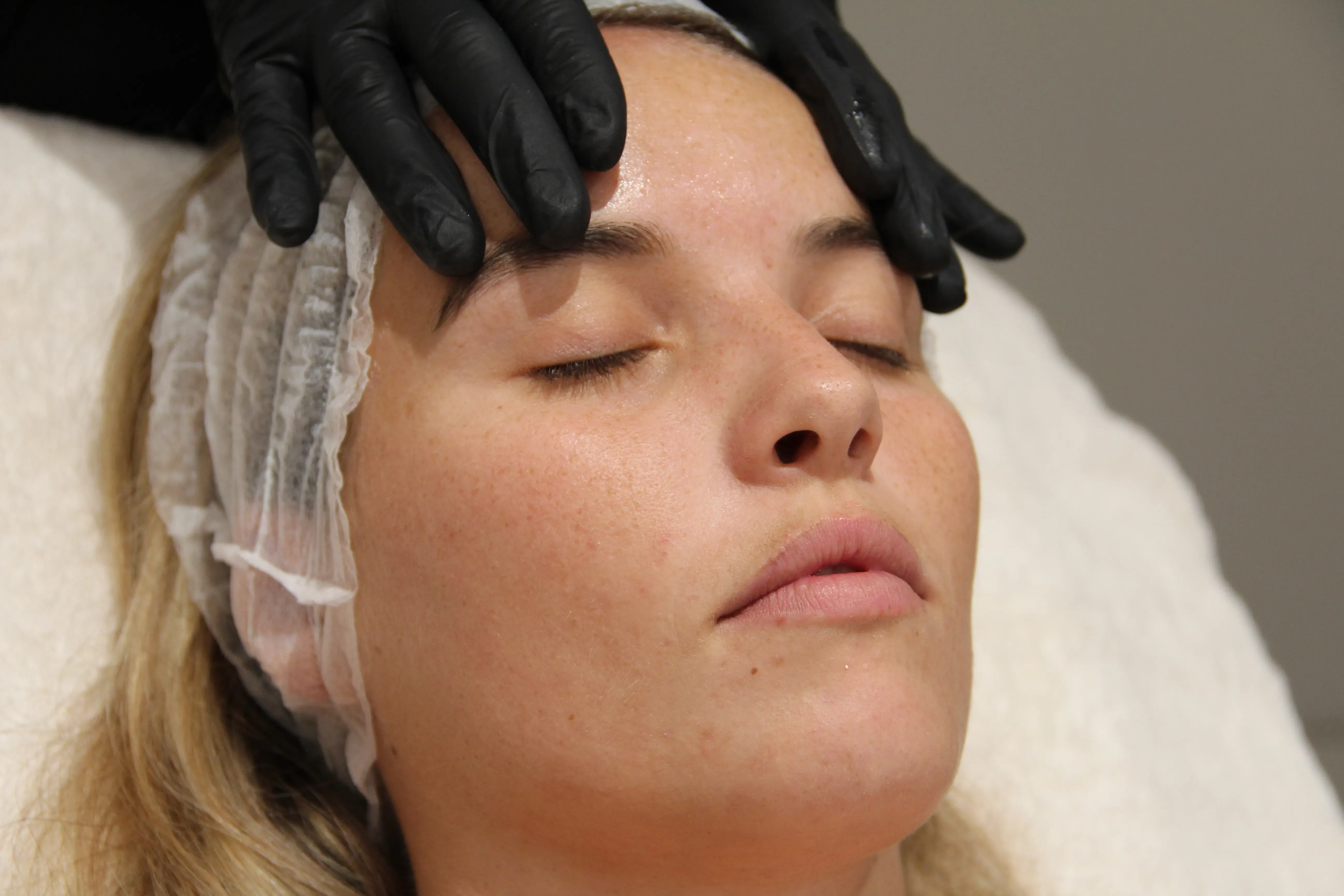 Tratamiento Regenerador, pieles Sensibles 