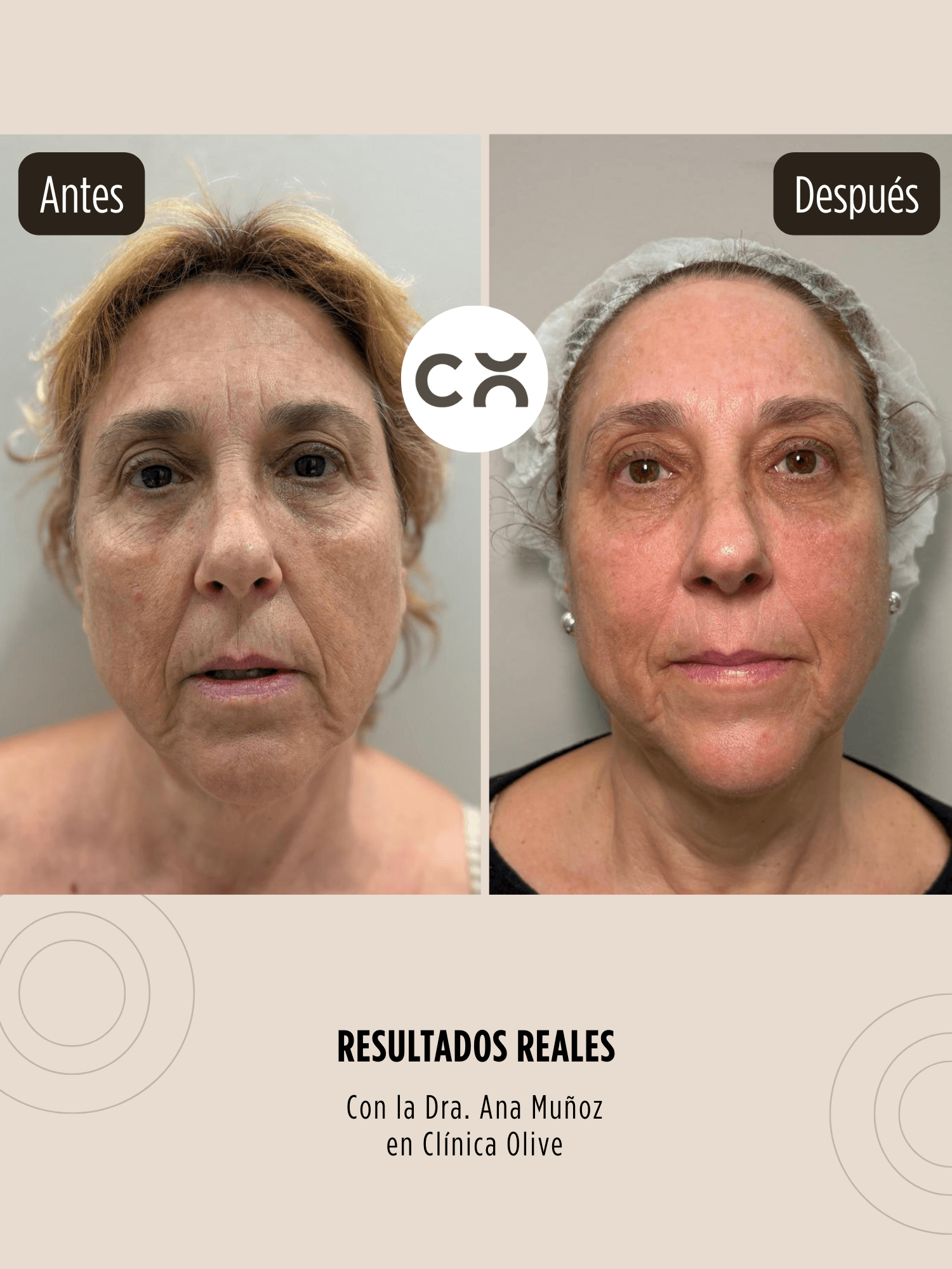 Resultados reales