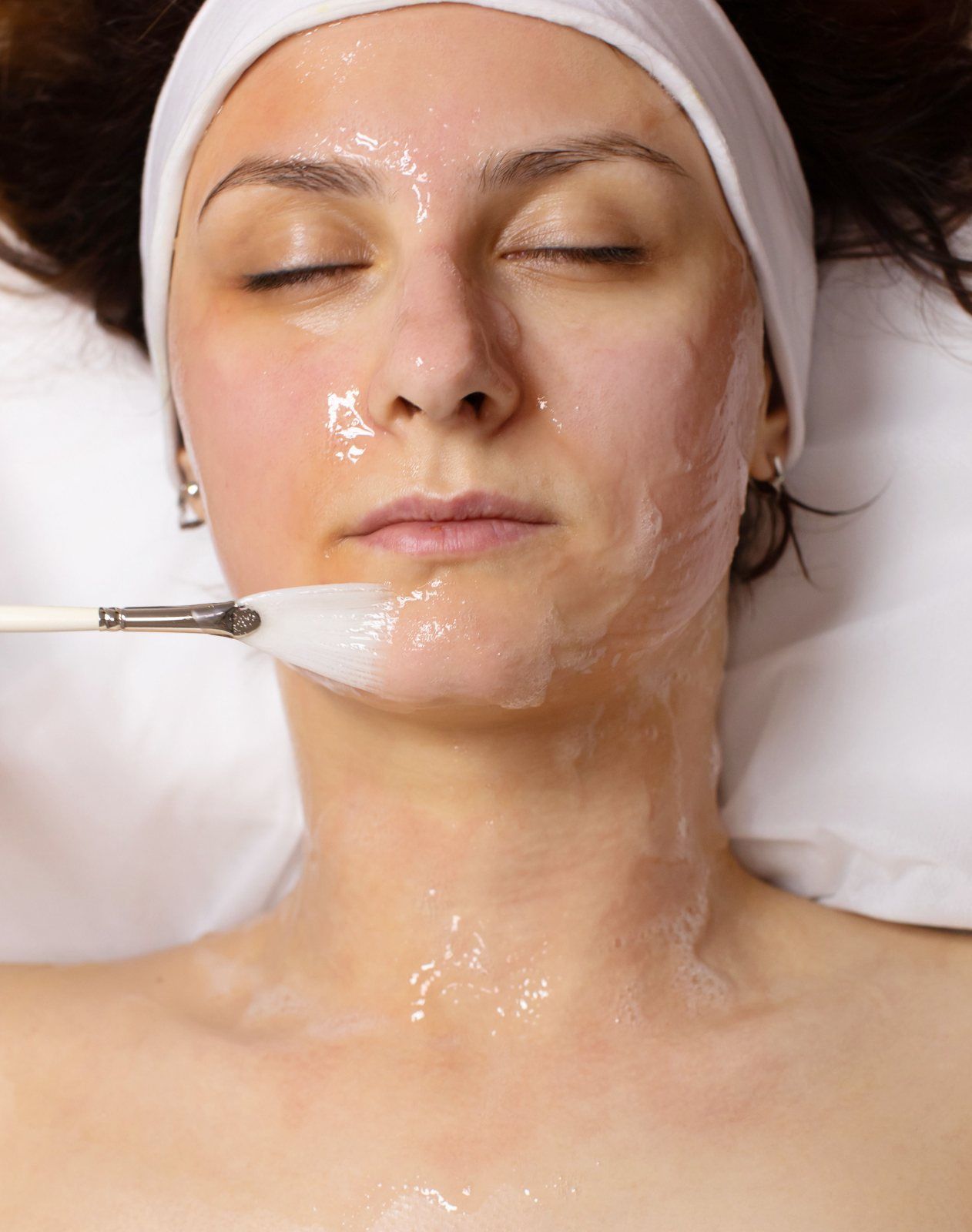 Peeling químico - Glicólico, retinol