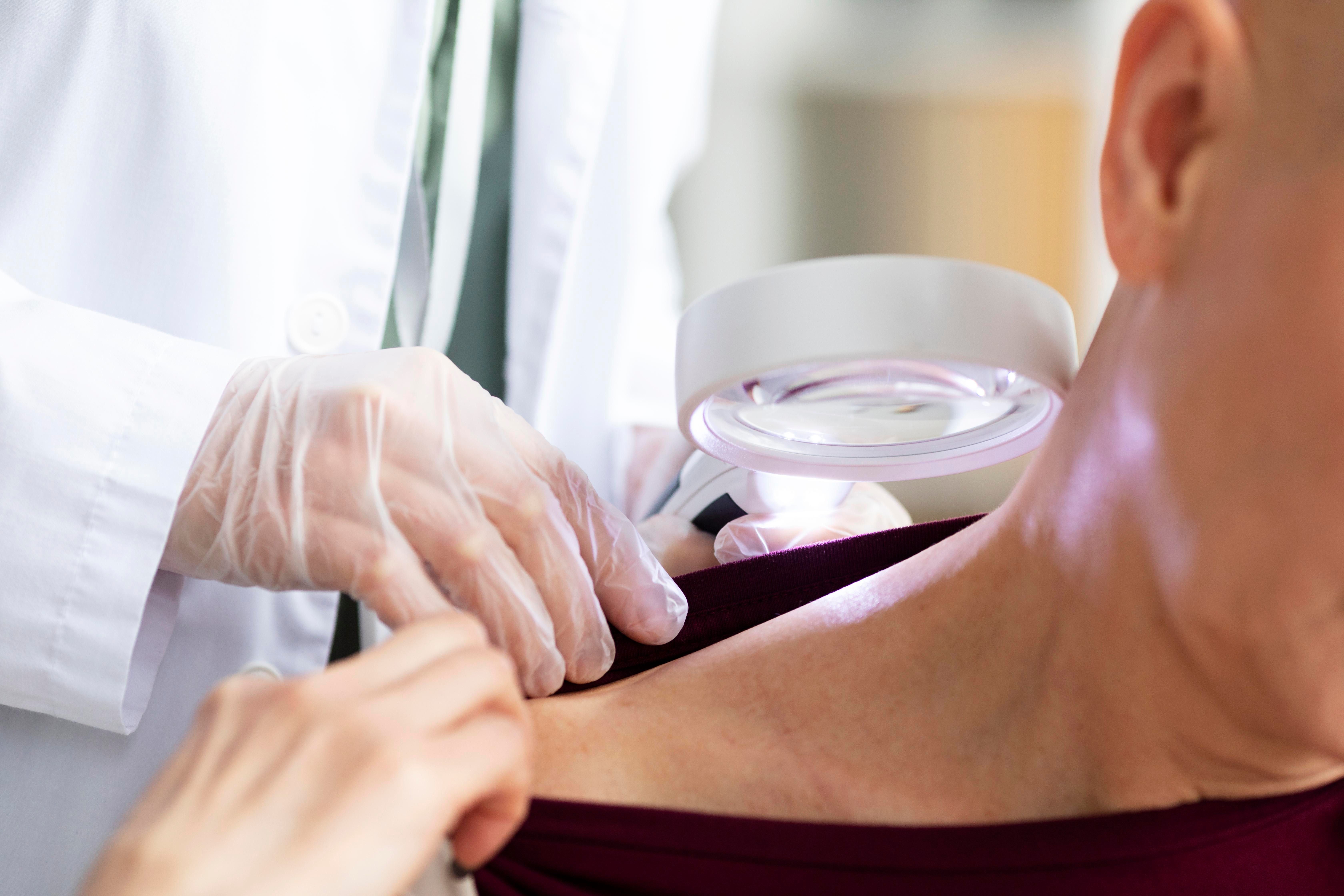 Consulta dermatológica