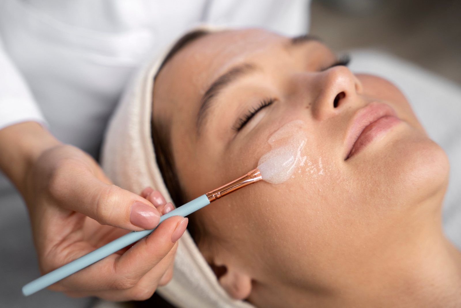Peeling químico (Antiedad)