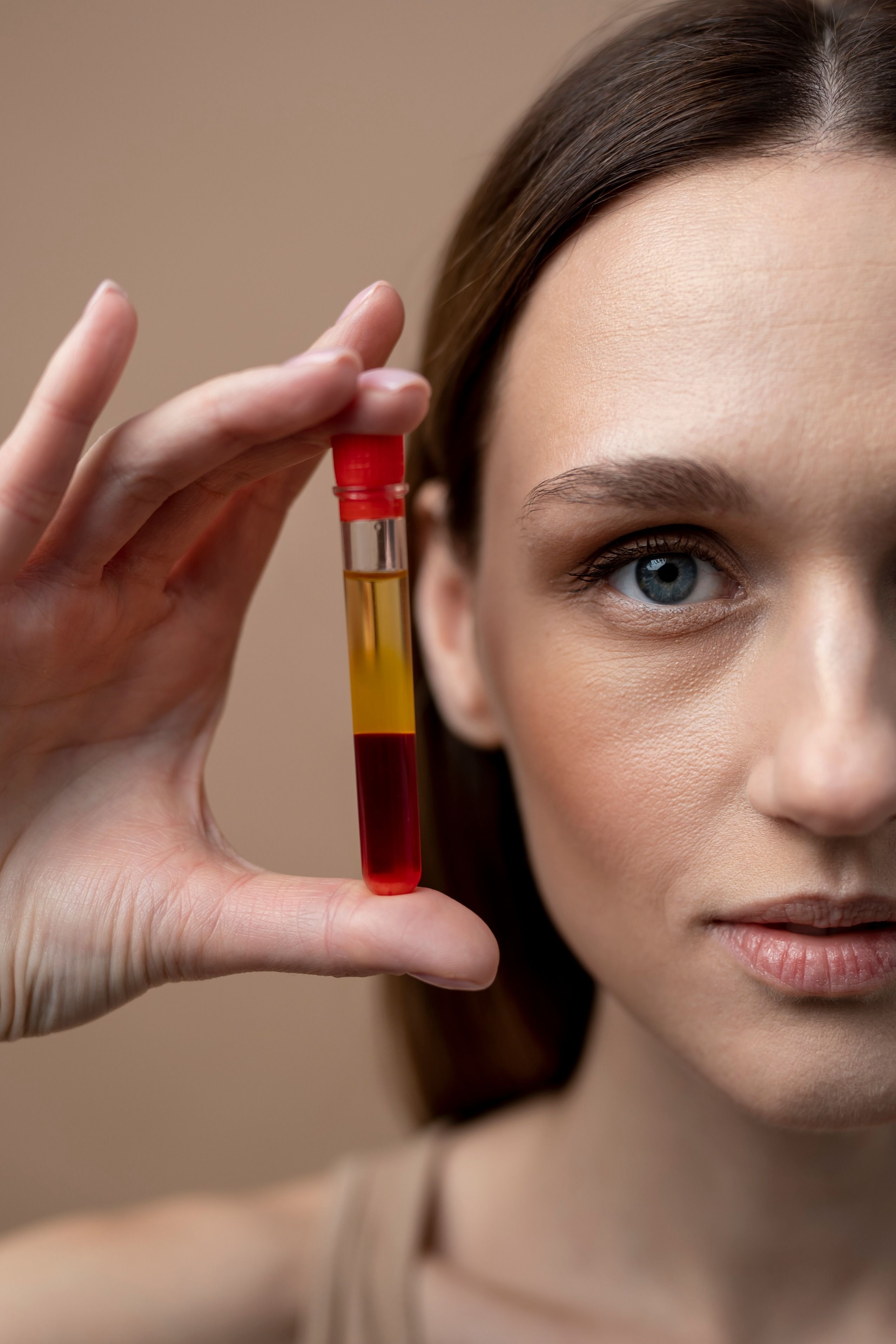 PRP (Plasma rico en plaquetas)