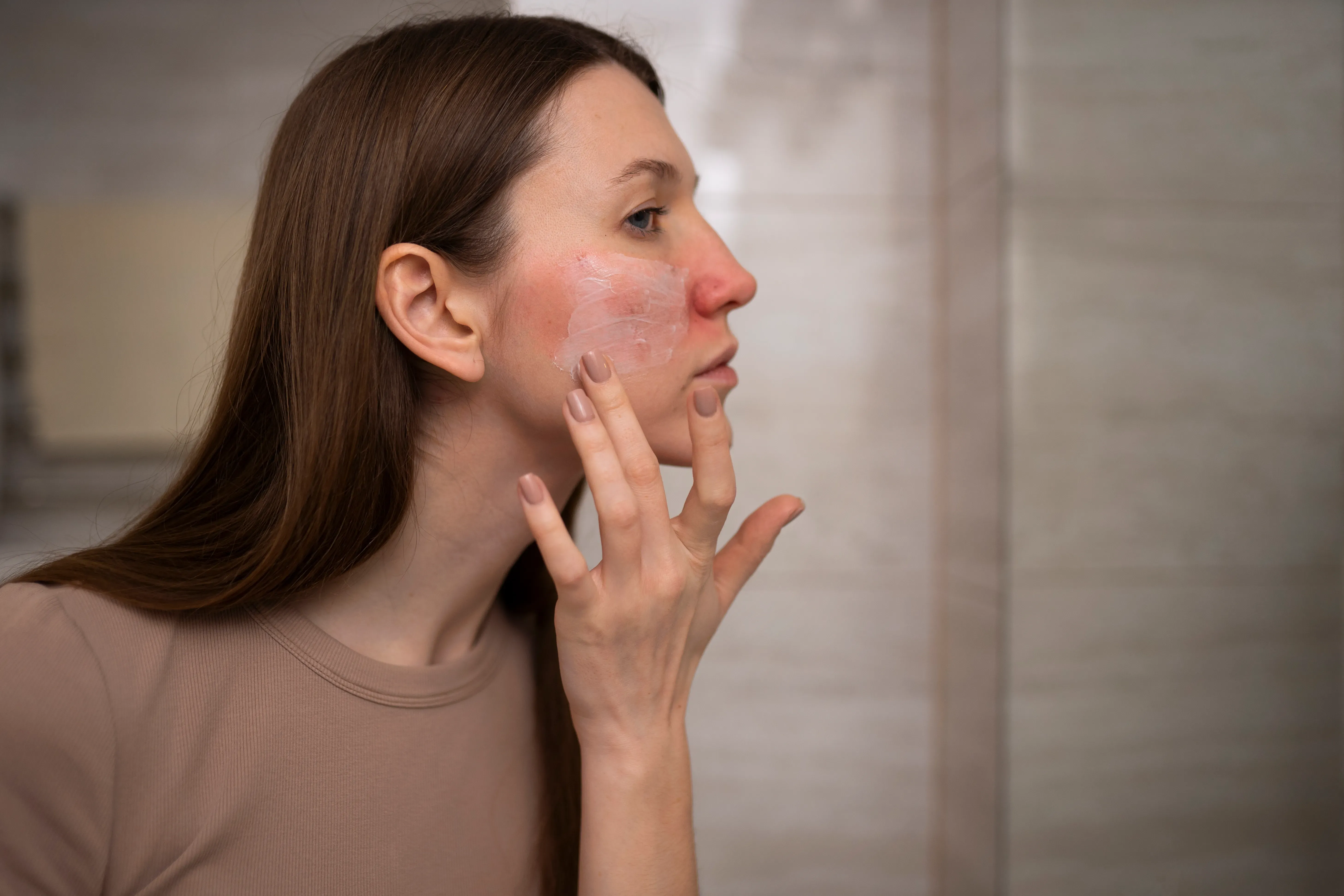 Láser IPL (Manchas, rosacea, cuperosis)