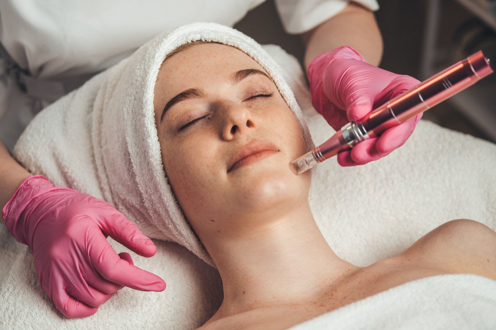 Tratamiento con dermapen /Microneedling