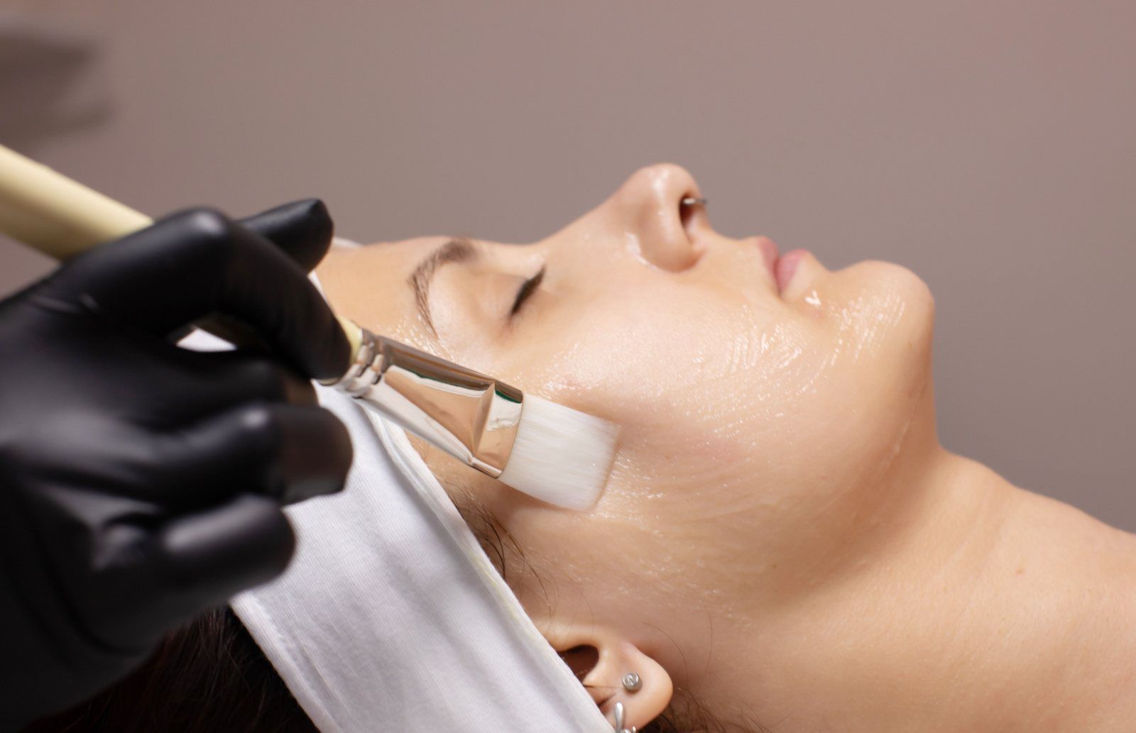 Peeling químico - Salicílico, Azelaico