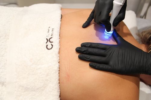 Aquapure tratamiento Intensivo