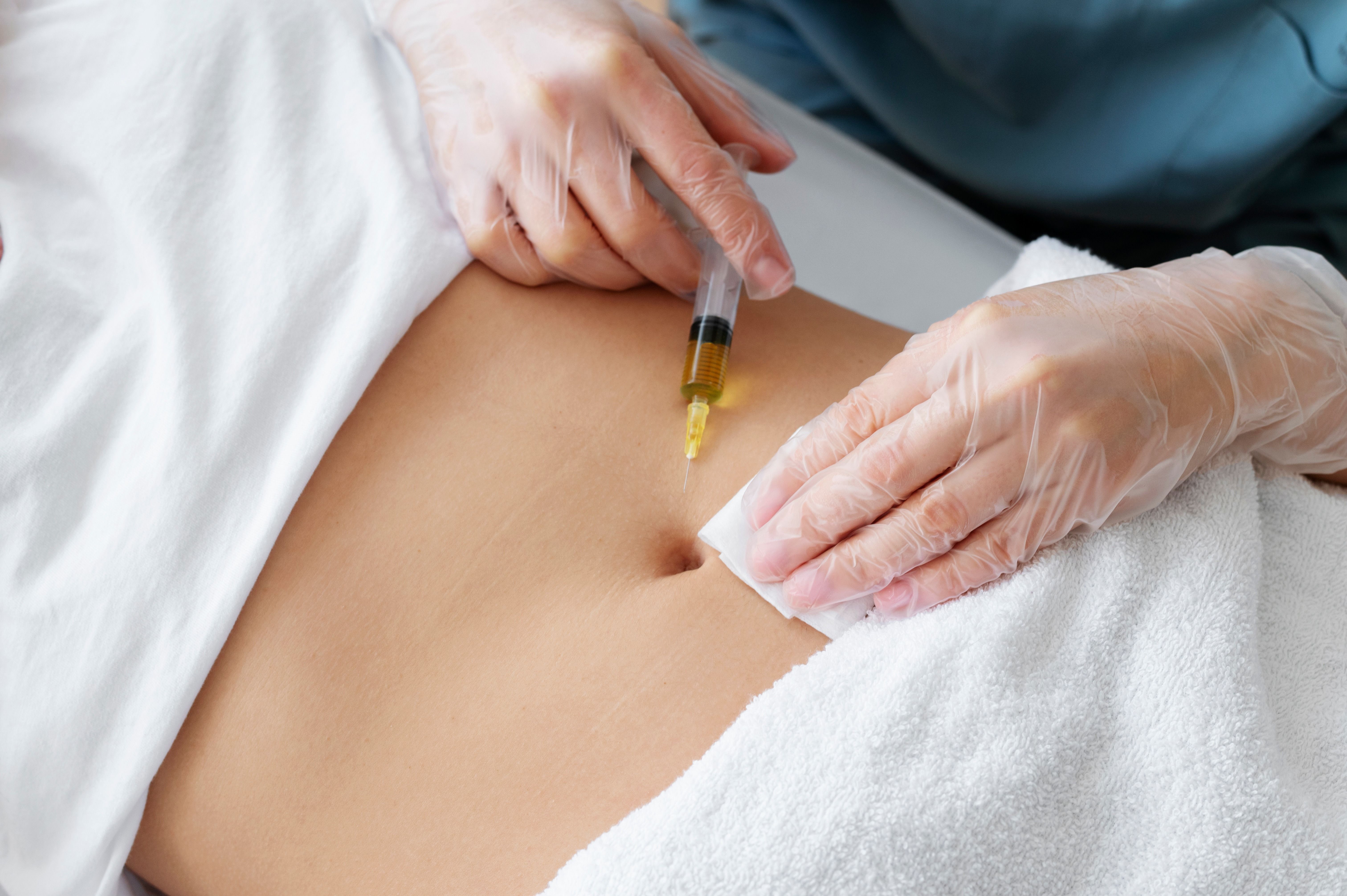  Mesoterapia corporal: Grasa localizada