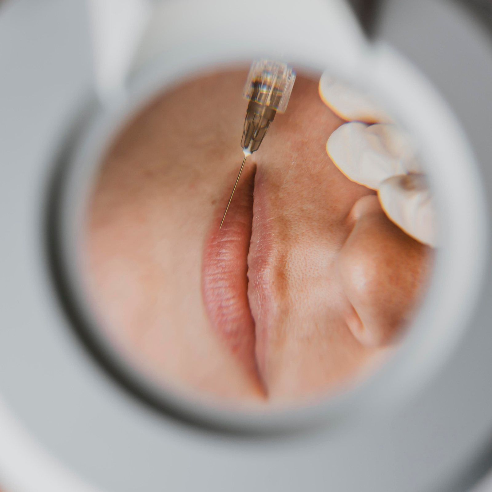 Labios jugosos con Aquapure